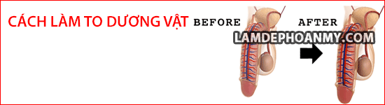 gel-titan-lam-to-duong-vat